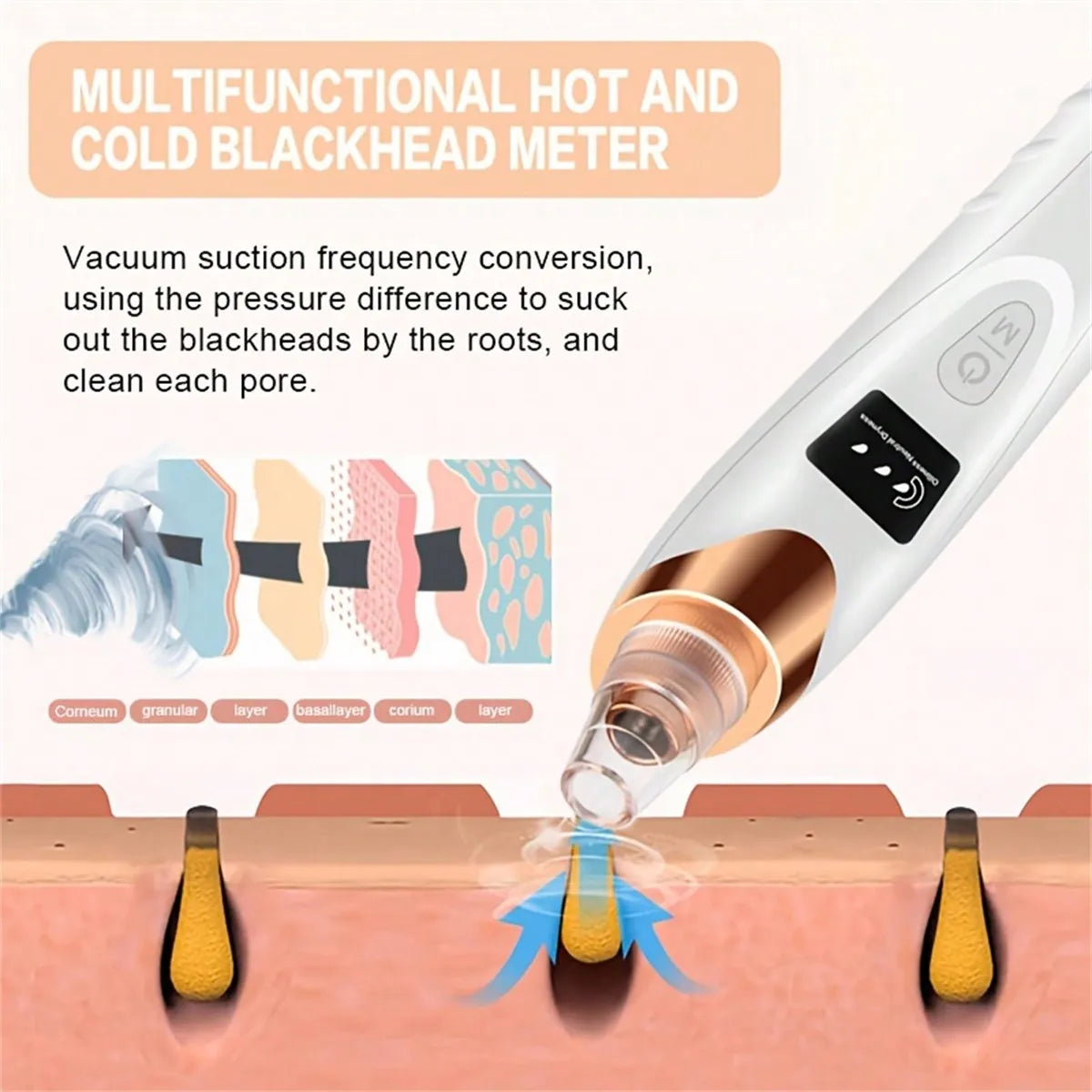 Electric Blackhead Remover Pore Vacuum –  Facial Cleaner