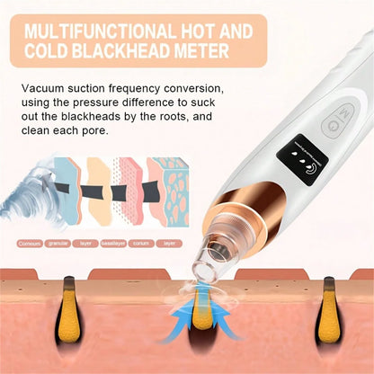 Electric Blackhead Remover Pore Vacuum –  Facial Cleaner