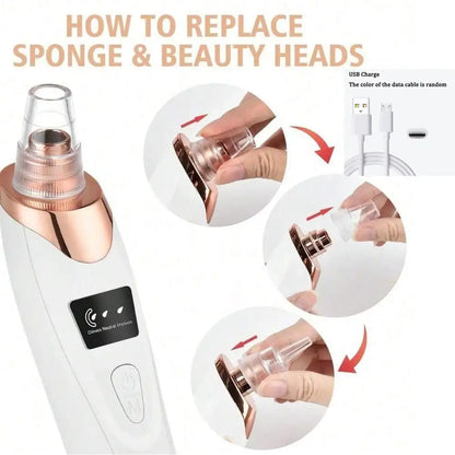 Electric Blackhead Remover Pore Vacuum –  Facial Cleaner