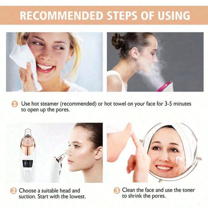 Electric Blackhead Remover Pore Vacuum –  Facial Cleaner