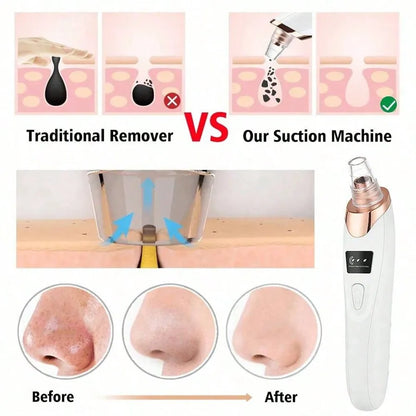 Electric Blackhead Remover Pore Vacuum –  Facial Cleaner