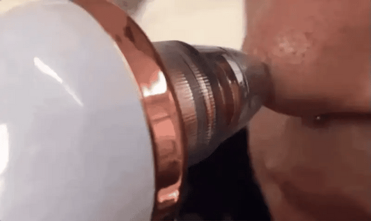 Electric Blackhead Remover Pore Vacuum –  Facial Cleaner