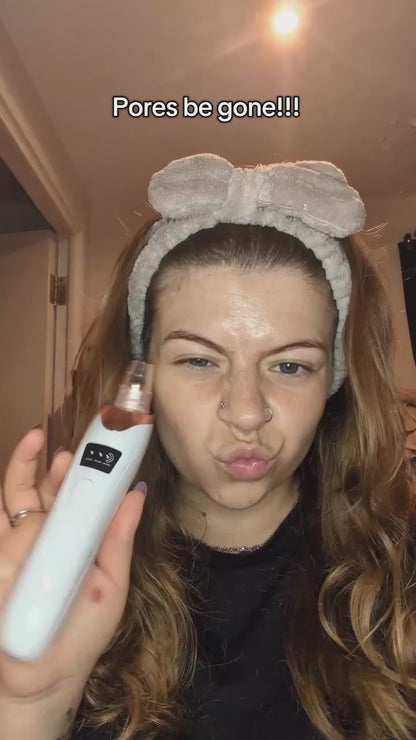 Electric Blackhead Remover Pore Vacuum –  Facial Cleaner